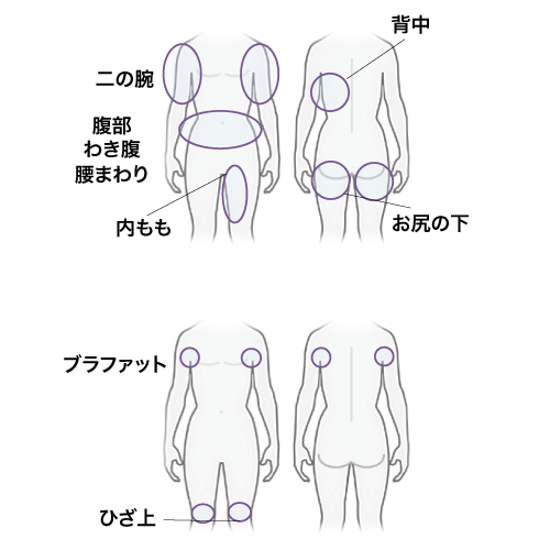 二の腕・腹部・太もも内部・脇腹・太もも上部